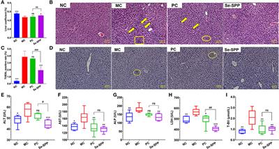 Selenium-containing polysaccharide from Spirulina platensis alleviates Cd-induced toxicity in mice by inhibiting liver inflammation mediated by gut microbiota